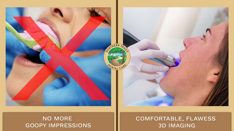 No More Goopy Impressions. Comfortable, Flawless 3D Imaging