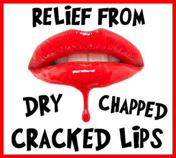 Gwinn dentist, Dr. Buck at Northern Trails Dental Care, tells you how to relieve your dry, chapped, and cracked lips!