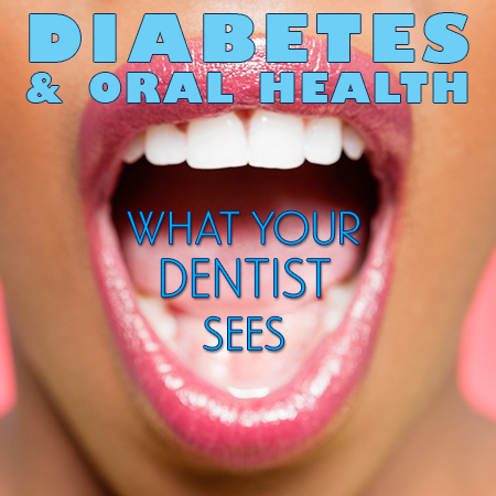 Gwinn dentist, Dr. Gwendolyn Buck of Northern Trails Dental Care, discusses the side effects of diabetes and how it affects your oral health.