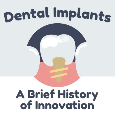 Gwinn dentist, Dr. Gwendolyn Buck of Northern Trails Dental Care discusses dental implants and shares some information about their history.