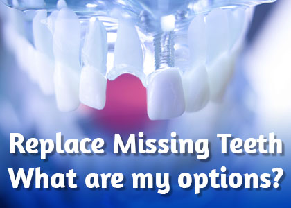 Gwinn dentist, Dr. Gwendolyn Buck of Northern Trails Dental Care discusses the tooth replacement options available to replace missing teeth and restore your smile.