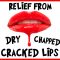 Relief from Dry, Chapped & Cracked Lips (featured image)