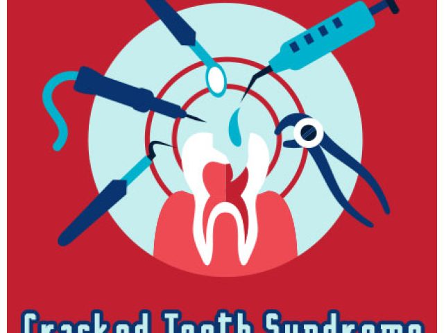 Crack Down on Cracked Tooth Syndrome (featured image)