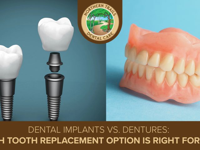 Dental Implants vs. Dentures: Which Tooth Replacement Option Is Right for You? (featured image)