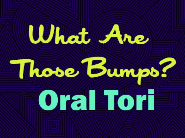 What Are Those Bumps? Oral Tori (featured image)