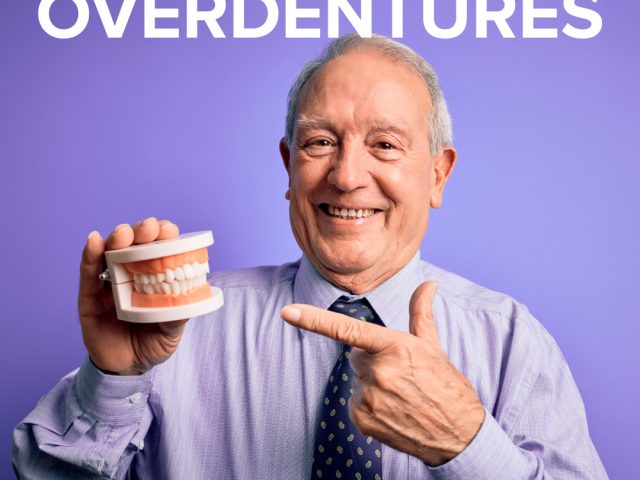 The Two Types Of Overdentures (featured image)