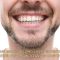 What Makes a Long-Lasting Dental Restoration (and How to Avoid Costly Re-Dos) (featured image)