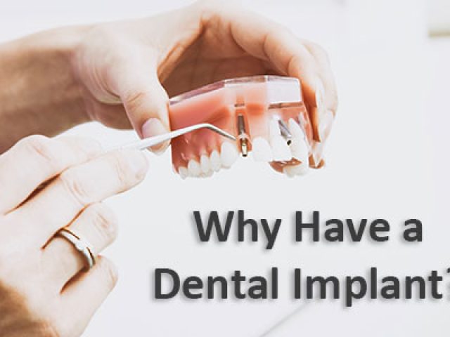 Why Have a Dental Implant? (featured image)
